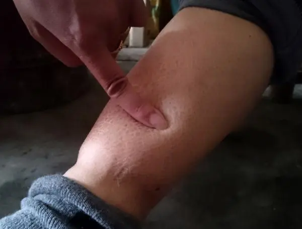 图片[2]-转载 肾透支-猫匿